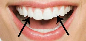 Teeth1.jpg